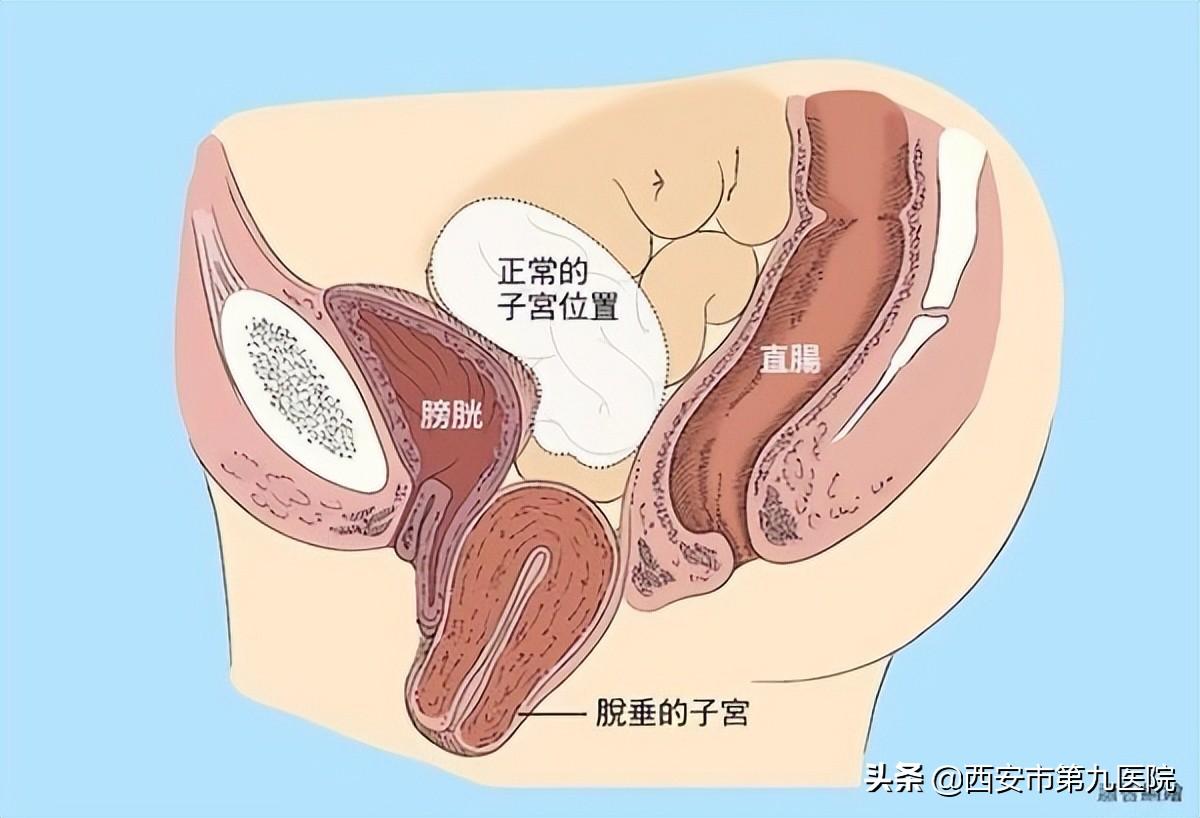 睪丸下垂松弛的原因及治療方法，睪丸下垂松弛的原因與治療方法解析
