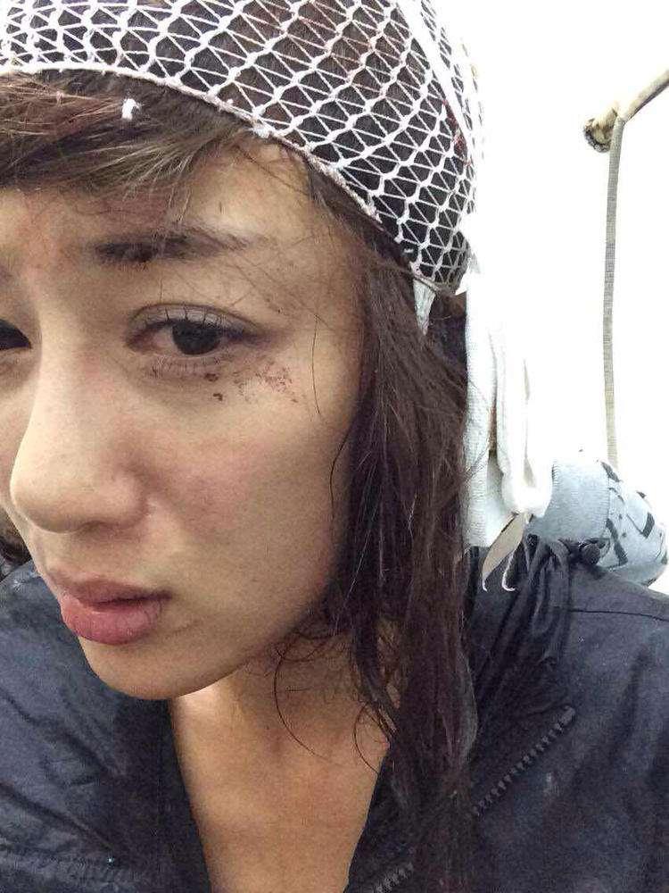 明星整容毀容最嚴重的是誰，深度探討與反思，深度探討與反思，哪位明星整容遭遇最慘重的毀容？